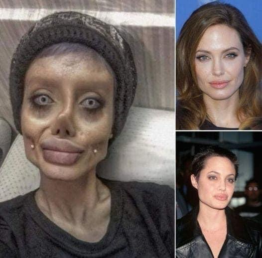 Sahar Tabar: A Controversial Transformation - My Healthy Life